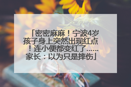 密密麻麻！宁波4岁孩子身上突然出现红点！连小便都变红了……家长：以为只是摔伤